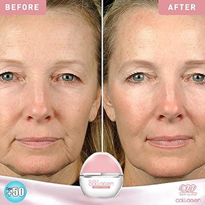 Eva Skin Clinic Collagen - Anti Sagging Cream (50+) - Image 2